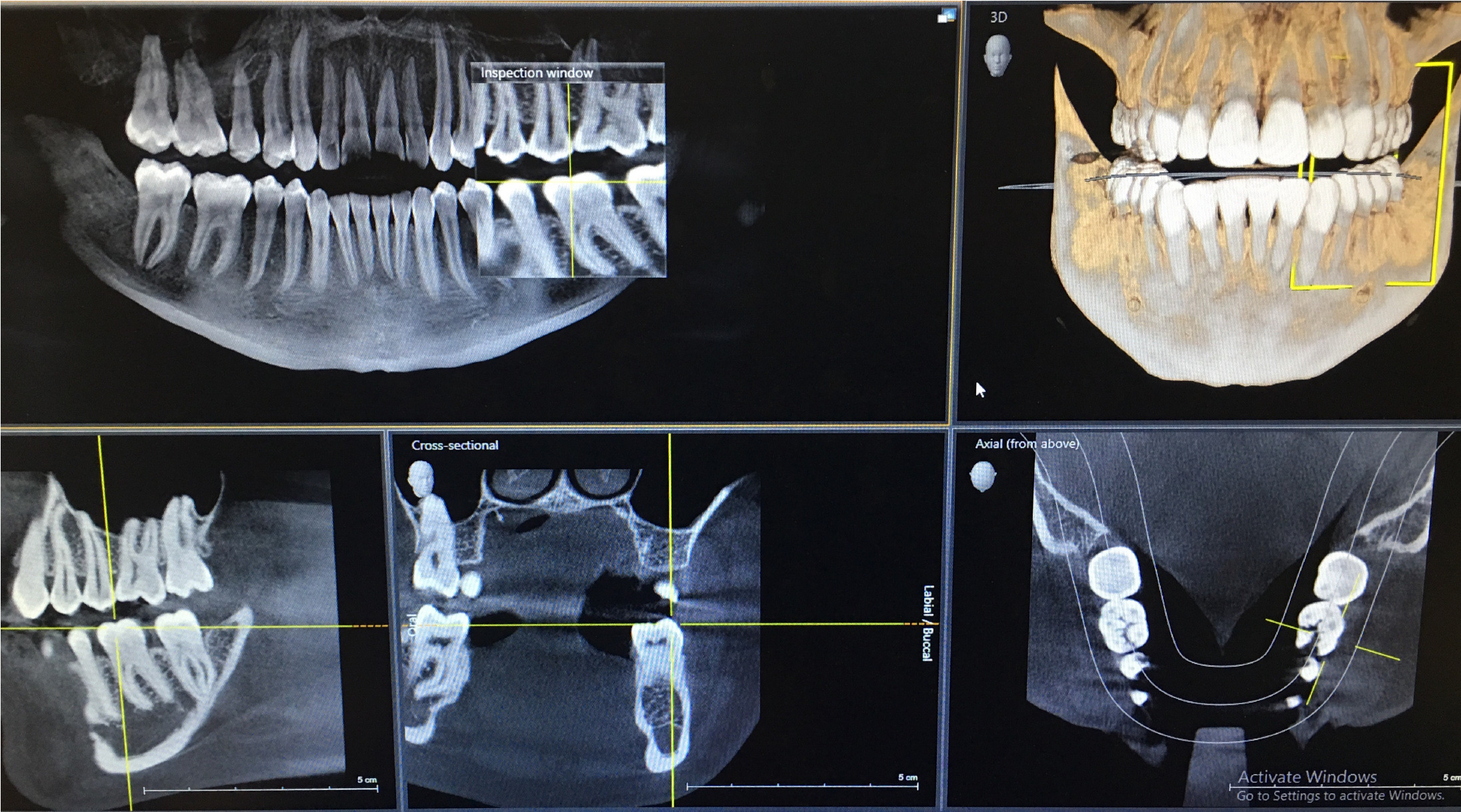 chromo-instituto-de-radiologia-odontol-gica-radiologia-digital-3d